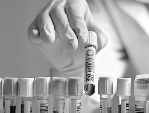 Renal_157986681-BW.jpg
